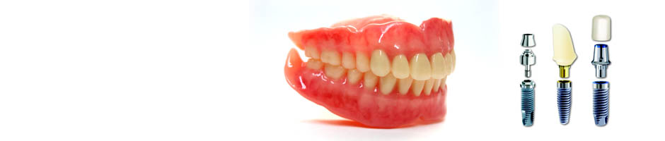入れ歯とインプラントの比較