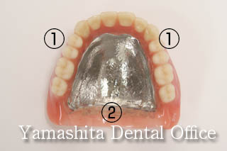 上顎吸着入れ歯の形