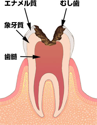 歯の構造