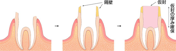 隔壁