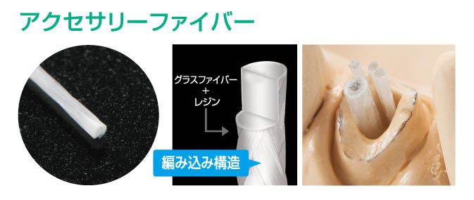 i-TFCシステム2