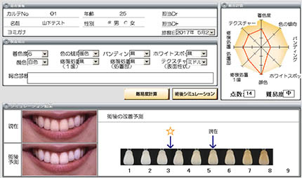 シェードアップシミュレーター